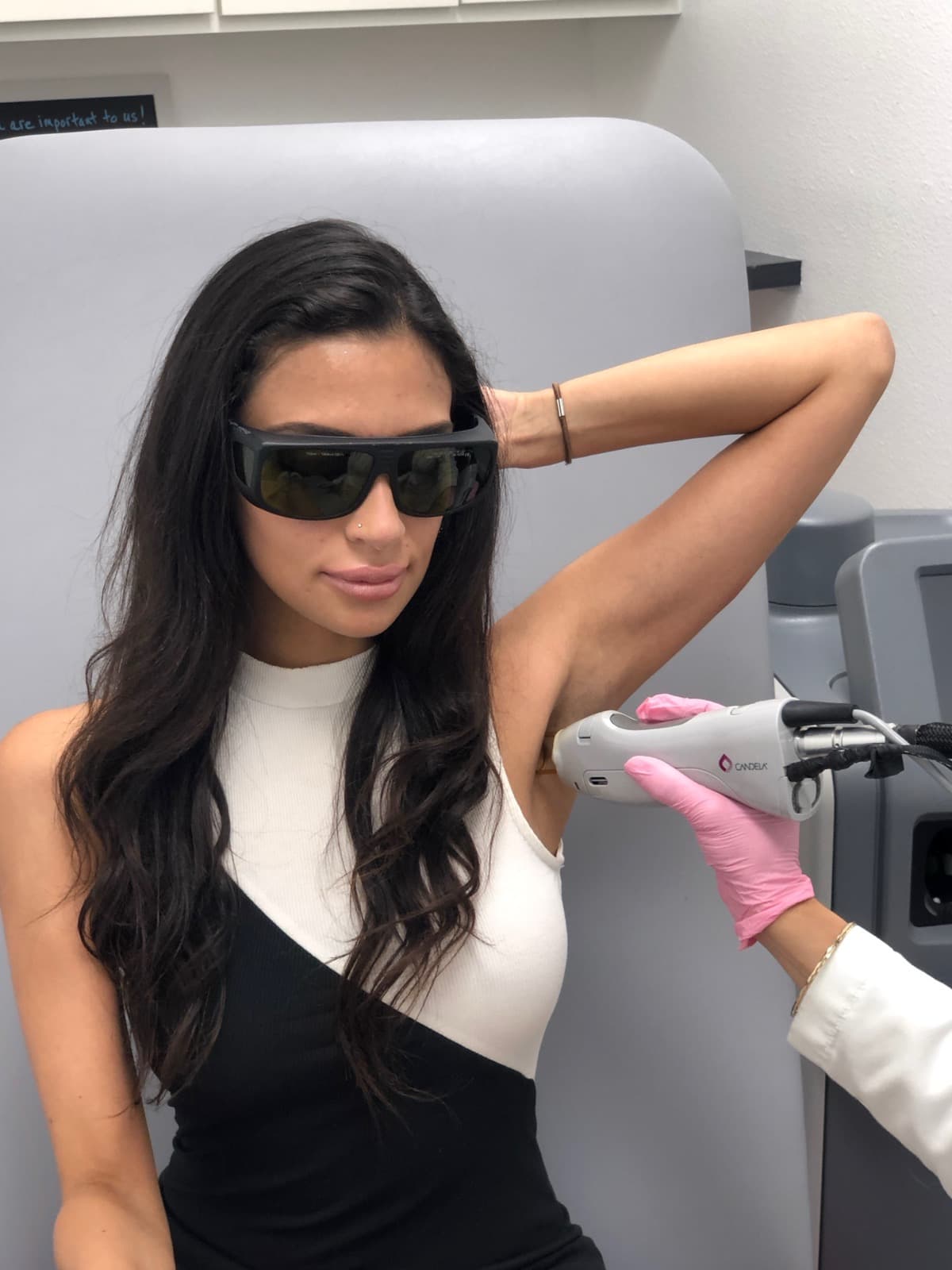 Close-up photograph of a laser hair removal procedure
